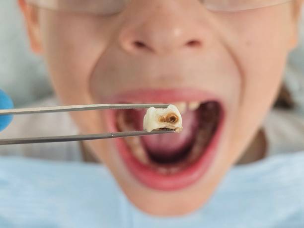 Best Emergency Denture Repair in Union City, OH
